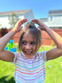 Millie frong on head